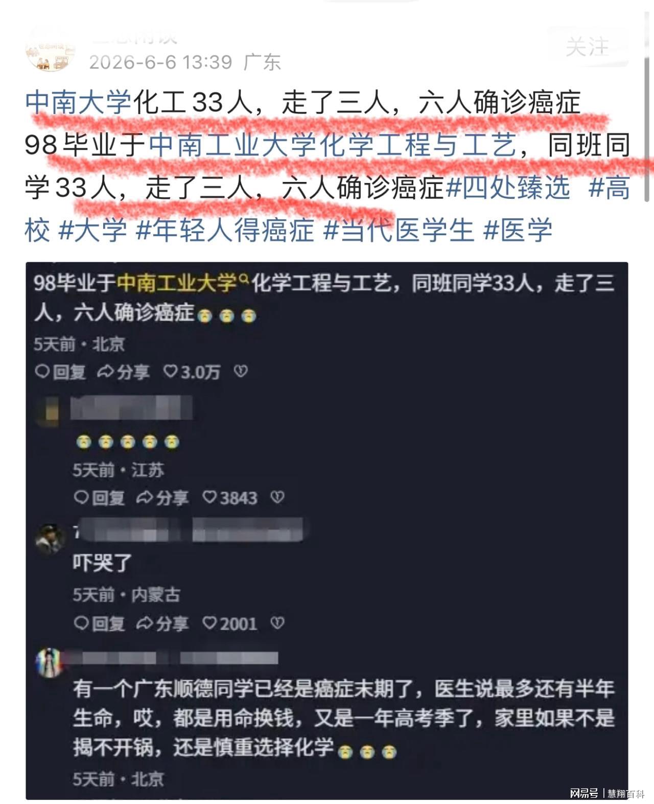 奇才榜眼萨尔接受右脚骨折手术